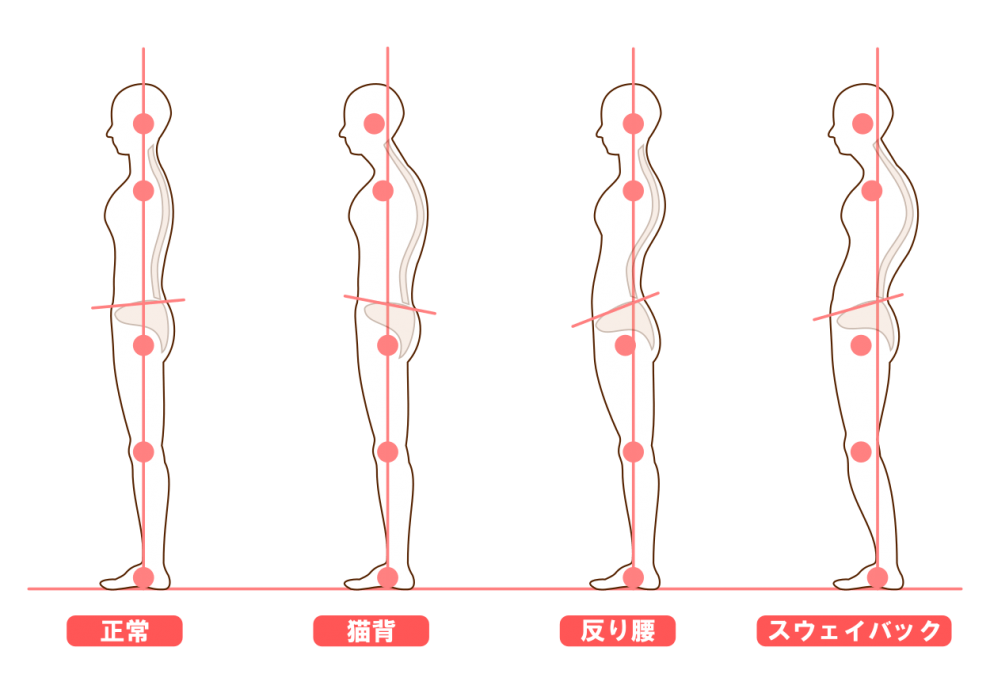 姿勢の崩れ