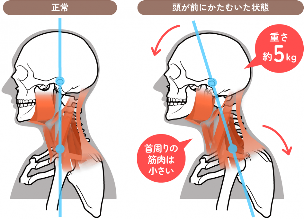 頭部のかたむき